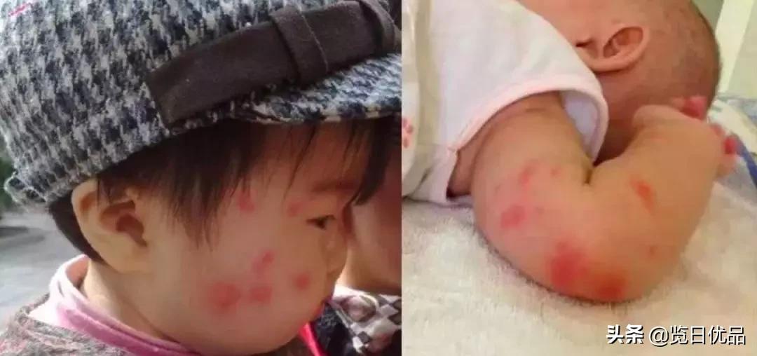 vape驱蚊喷雾驱蚊水 (vape驱蚊水哪个颜色驱蚊效果好)