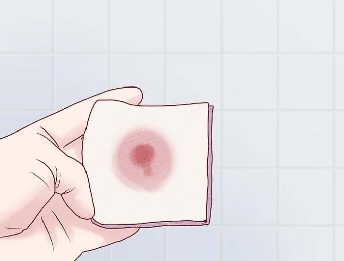 如果有轻微痔疮要怎么改善,得了痔疮不要怕食疗简单又方便