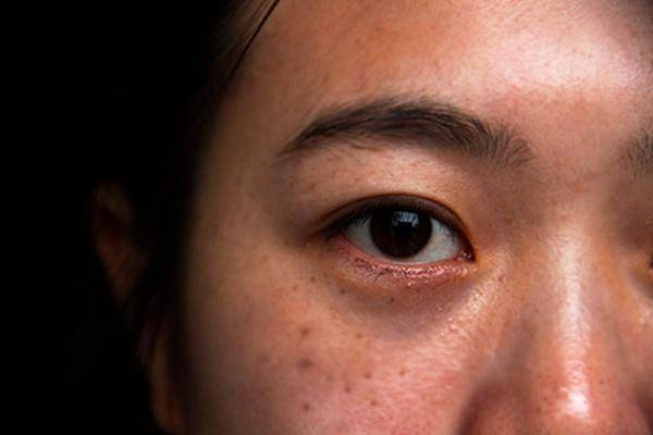 ps去雀斑最有效的小妙招,ps祛雀斑的最佳方法