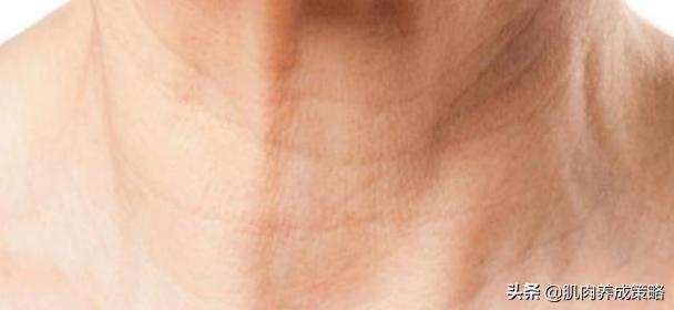 如何锻炼脖子不长皱纹,人脖子长皱纹用什么方法