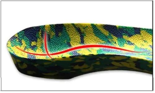 中老年女性拇外翻能矫正过来吗,女性脚拇指外翻原因