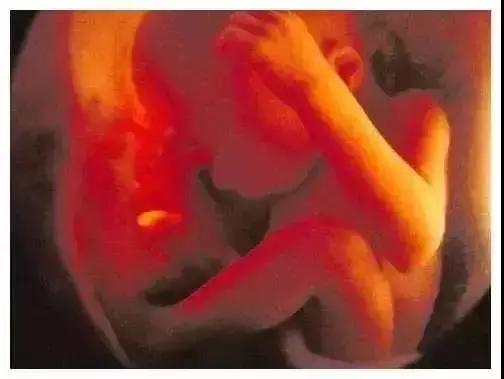 孕期最后一次大检查一定要做吗,孕期大排畸最好在哪个周