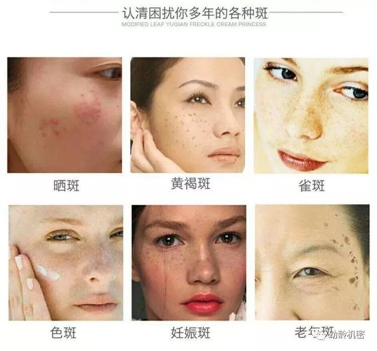 面部细菌感染,面部细菌怎么消除