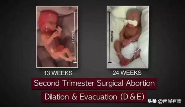 堕胎可怕吗,堕胎到底多可怕