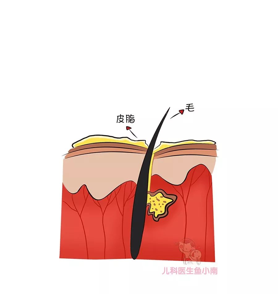 湿疹宝宝着凉了怎么办,湿疹宝宝需要调理么