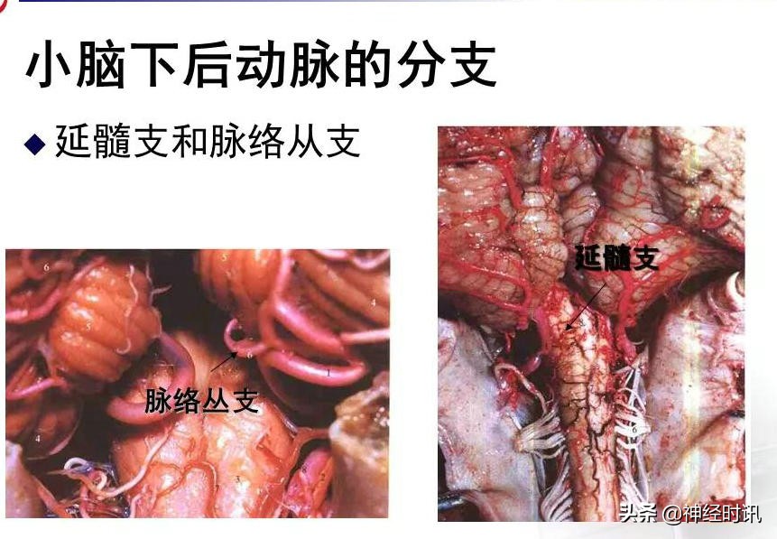 脑动脉解剖学讲解,基底节区脑血管解剖