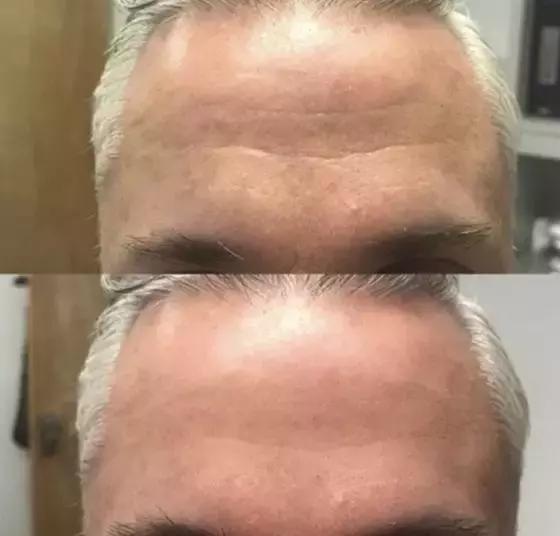 补水保湿淡化黑眼圈眼袋,黑眼袋黑眼圈用什么护肤品消除