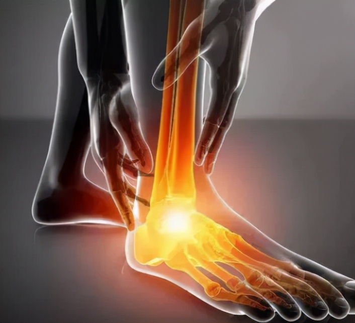 跟骨骨折和足跟骨刺哪个严重,足跟骨刺走路疼痛该如何治疗