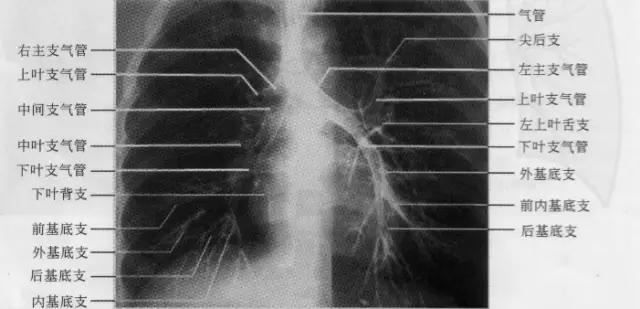 x线影像解剖大全,胸部x线怎么看懂图解