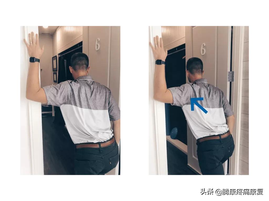 肩峰下撞击综合征的症状,肩峰下撞击综合征的机制是什么