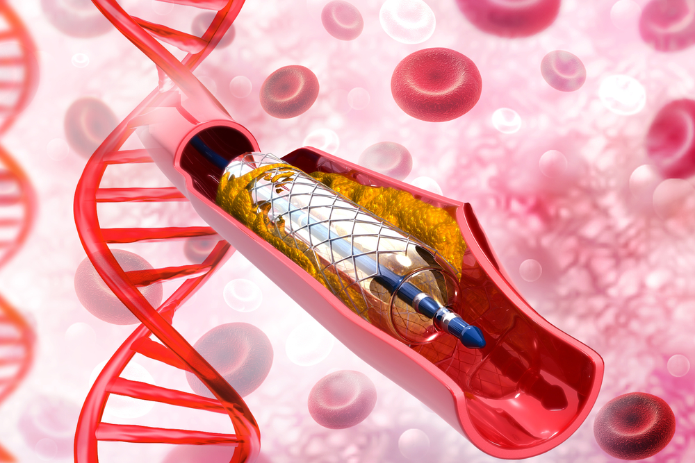 血栓一旦形成可以逆转吗,形成了血栓用抗凝药可以消除吗