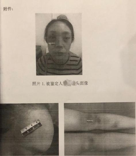 没有最虐只有更虐,没有最糟只有更糟