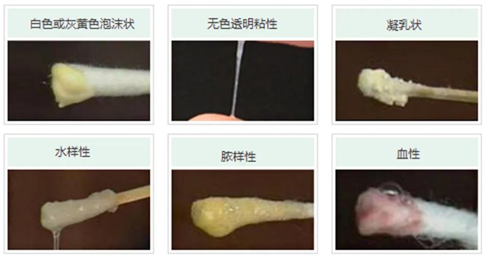 白带检查医生开两张单结果都一样,如何看懂白带支原体结果