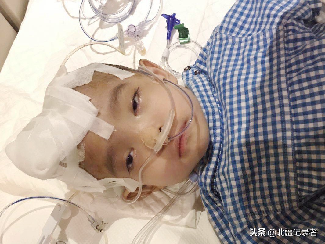 罕见病泡泡男孩,泡泡男童