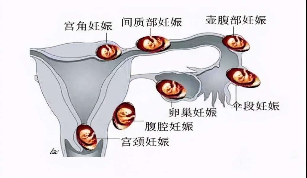 女生糟蹋输卵管的4种方式，严重可致不孕，看看你中招了吗？