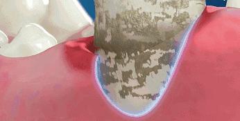 高伟光同款牙刷,高伟光牙刷介绍