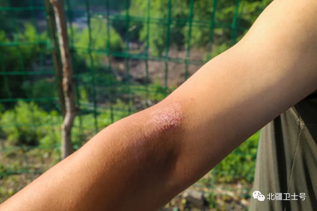 防晒pa3+能防晒多久,防晒pa3+1防晒系数高吗