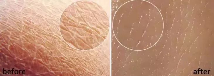 乳木果润肤裤穿搭,乳木果润肤保湿裤