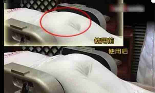 产后骨盆和盆底肌修复有必要做吗,产后骨盆修复与盆底肌修复的区别