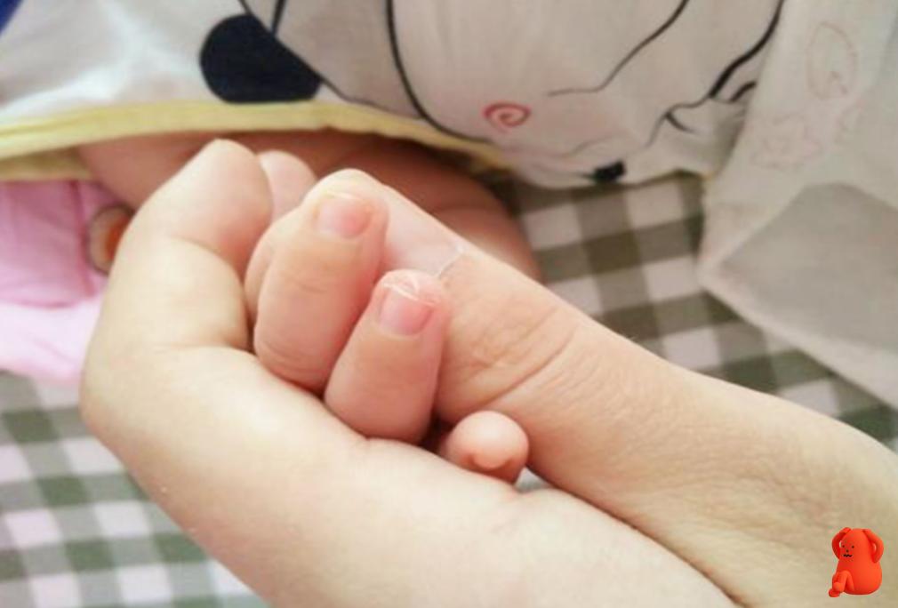 宝宝指甲白是缺什么,宝宝指甲是软的是怎么回事