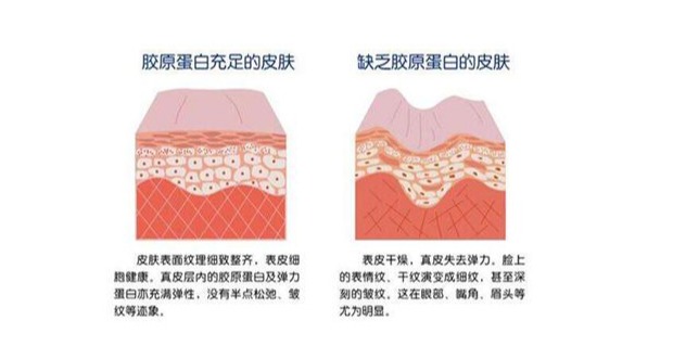 松下美容仪xep和xrf区别,松下x系列美容仪评测