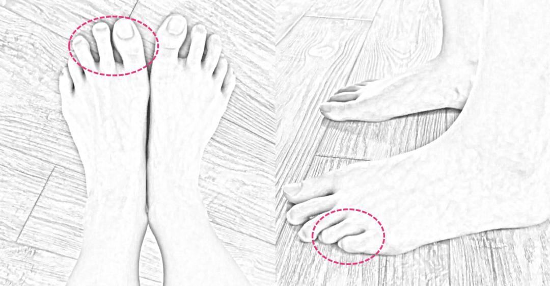 小腿粗穿什么款的鞋子好看,帮你选鞋