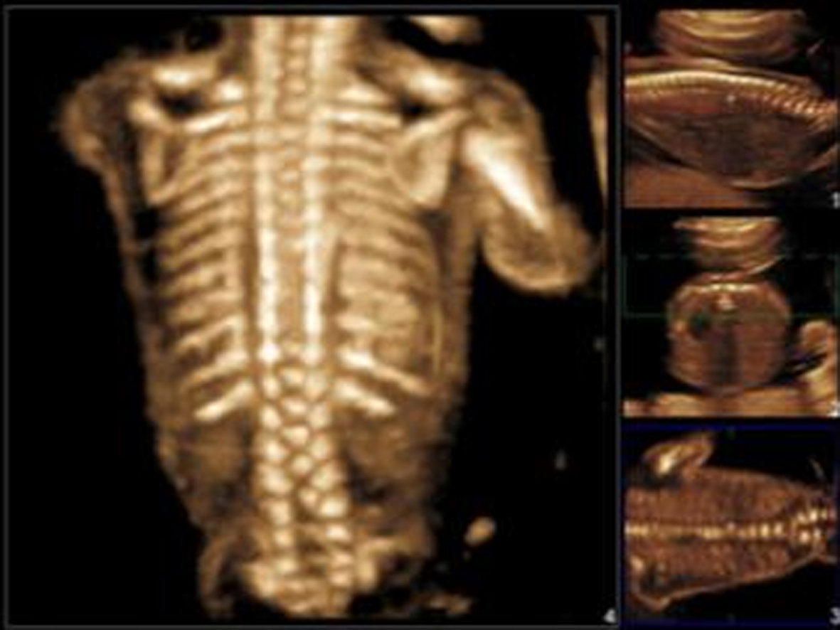 胎儿神经系统发育异常的超声表现,胎儿中枢神经系统超声检查视频