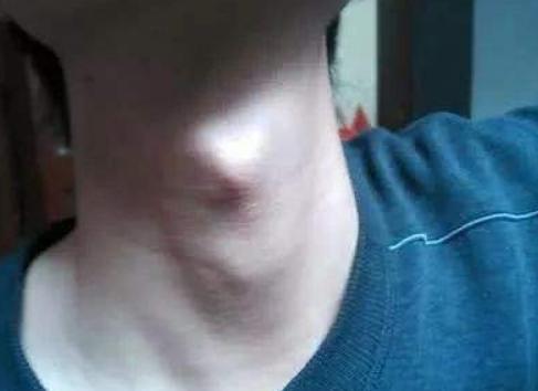 12岁男孩只有136cm,父母着急不已,半年后孩子却长到了152cm!