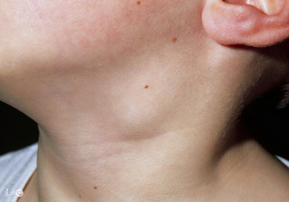 手术中的病理检查准确率高吗,手术病理