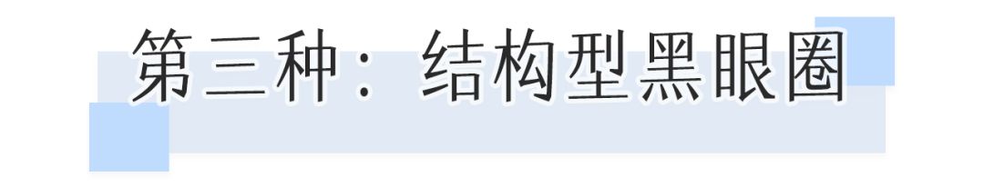董氏奇穴一针治疗黑眼圈,熊猫针一针就能去掉黑眼圈吗