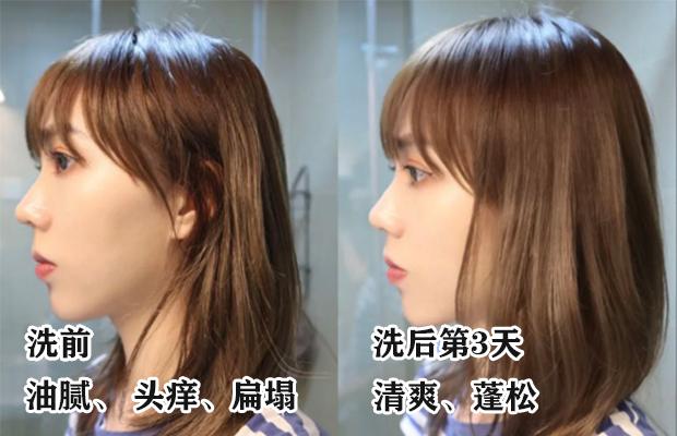 明星亲测生发液,明星亲测养生