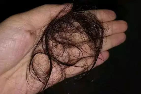 吃了优甲乐身体变瘦为什么,吃了优甲乐还严重起来啥原因