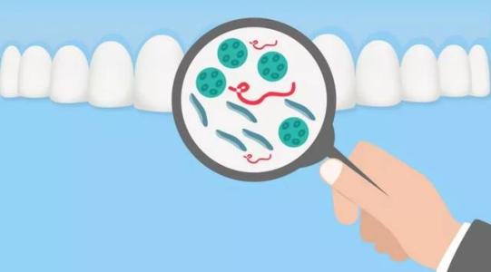 牙结石和牙结石怎么区分,牙结石颜色的鉴别