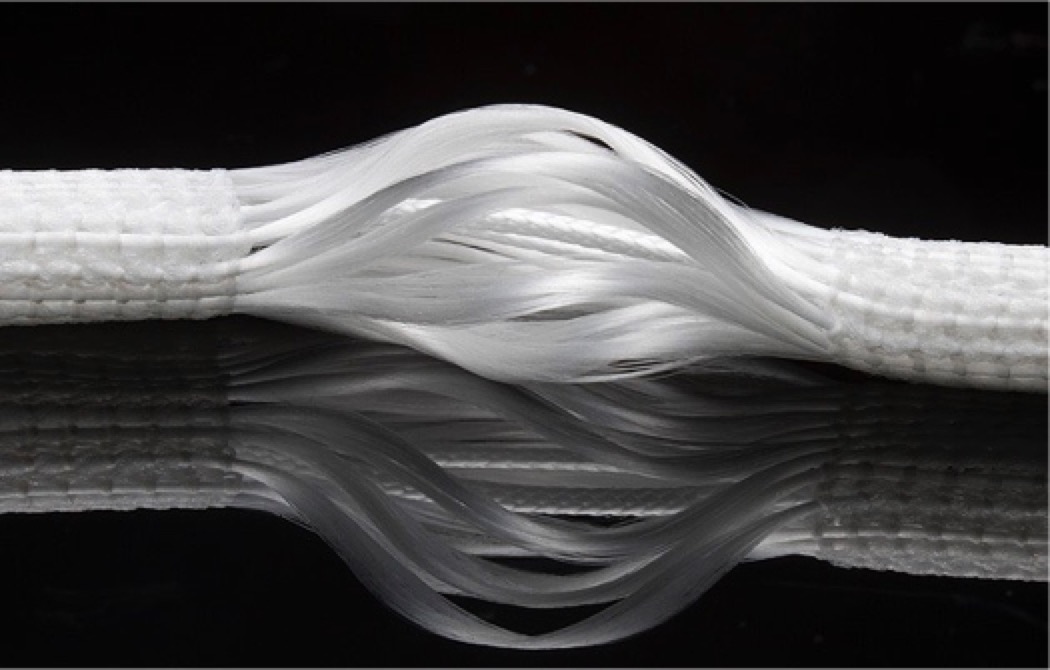 膝盖前叉韧带重建怎么康复,重建膝关节前交叉韧带多久能行走