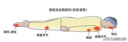 世界压疮预防日,预防压疮和护理压疮