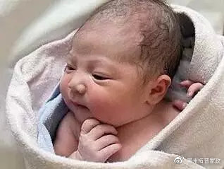 婴儿尿布湿疹的最快自愈方法,婴儿湿疹痤疮尿布疹