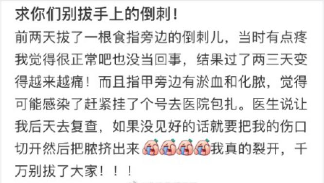 倒刺可以用手撕吗,撕倒刺感染会不会自己好