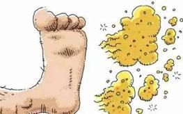 脚丫夏天出汗怎么办,夏天来了脚出汗怎么办