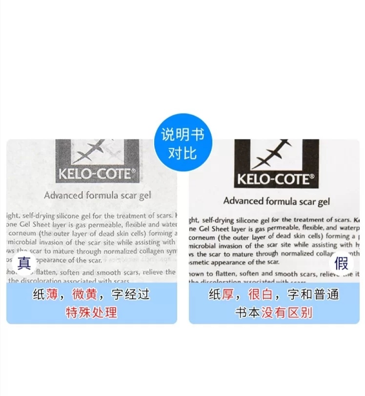 你用过最好的祛疤方法,小红书推荐祛疤真的有效吗