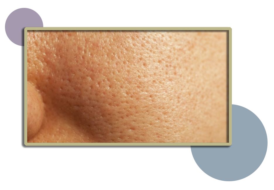 控油清洁毛孔,清洁控油收缩毛孔步骤