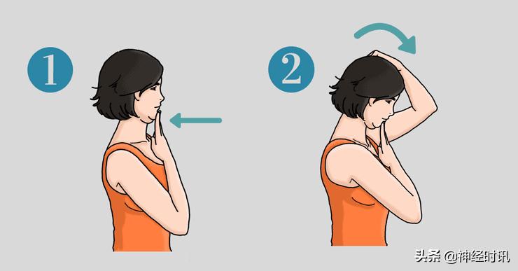 颈丛神经卡压症有什么表现怎么治,颈部神经卡压怎样松解视频