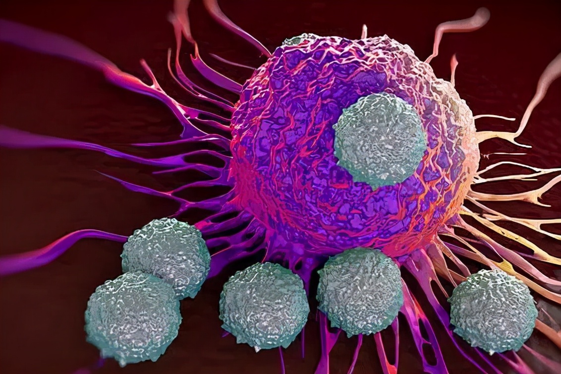 癌症发病率居高不下！女性如何治疗宫颈癌？