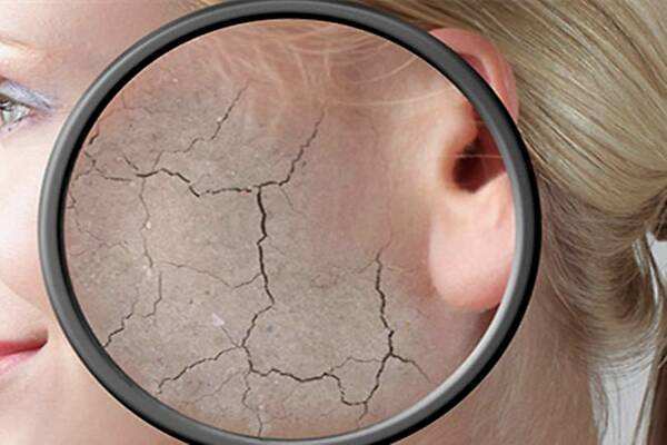 如何区分肤质干皮还是油皮,如何区别干皮或油皮肌肤