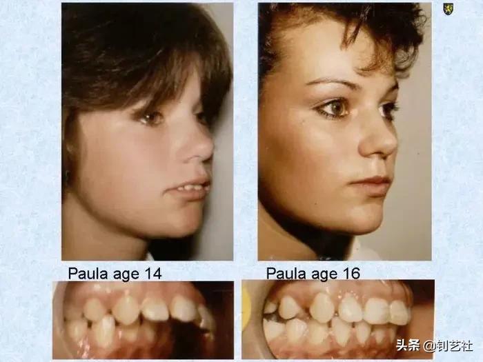 容易让人变丑的10个姿势,你最喜欢的站姿