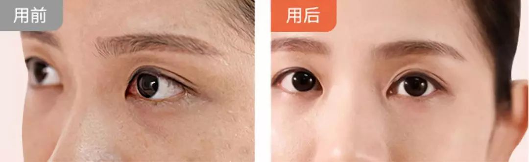 李湘代言美容仪,李湘护肤视频