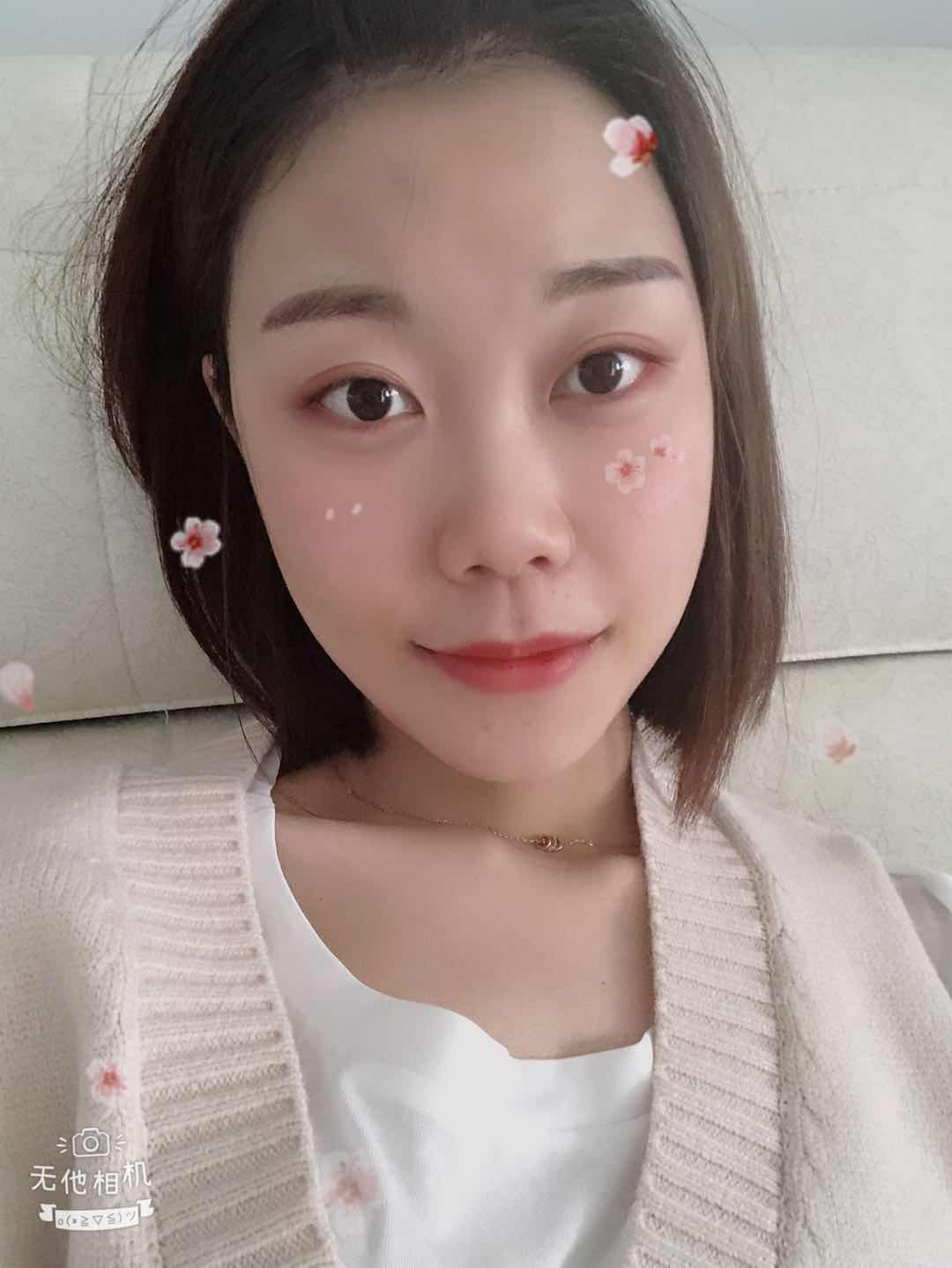 5万整容手术成功案例,女子花50万整容变毁容