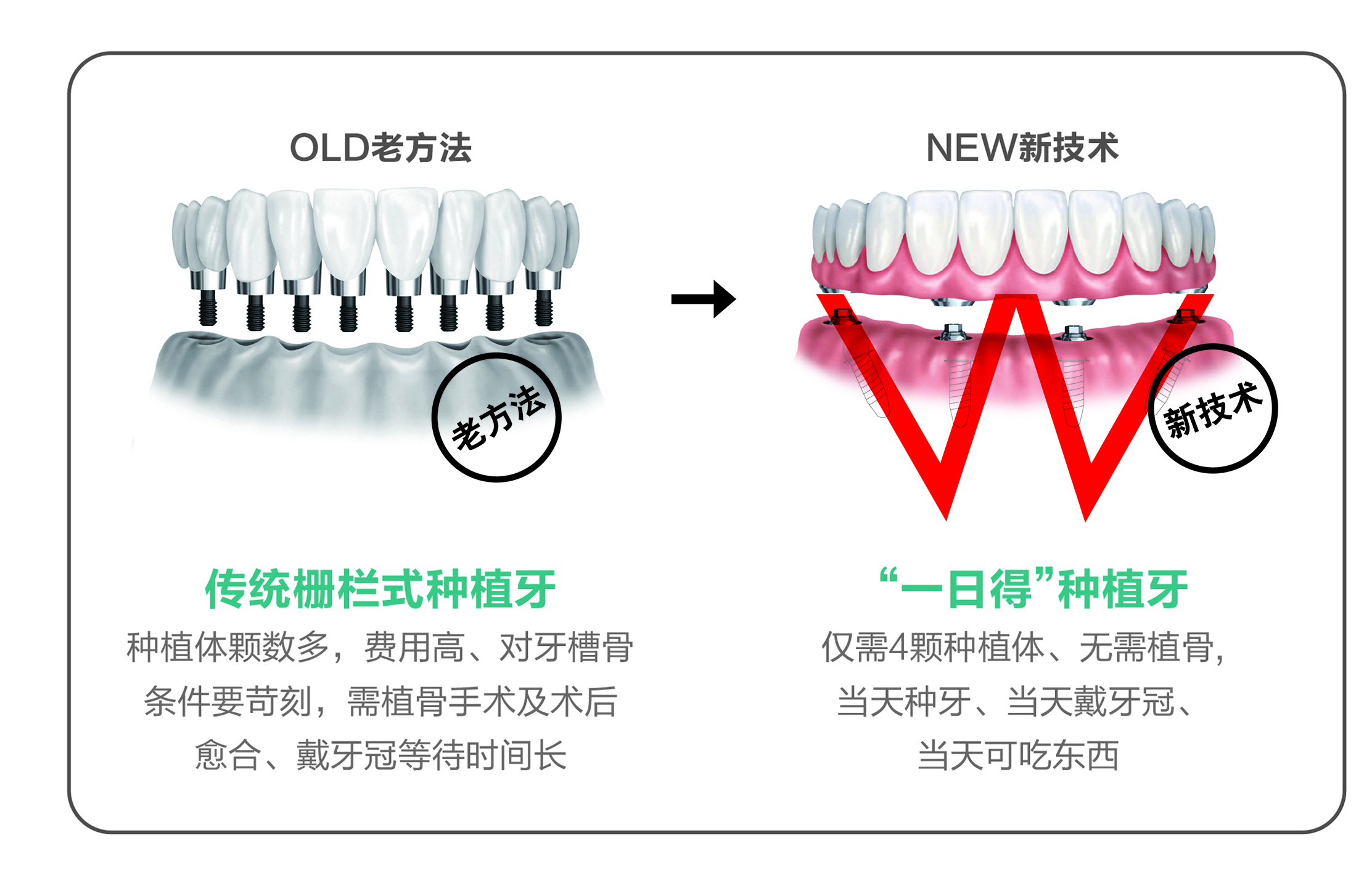 假牙不给力,假牙使不上力