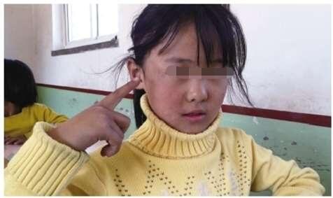 九岁女孩总脑袋疼,九岁女孩突然头疼发烧没有感冒