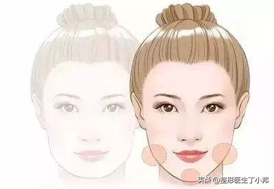 打瘦脸针违法吗,打瘦脸针医生会做假吗