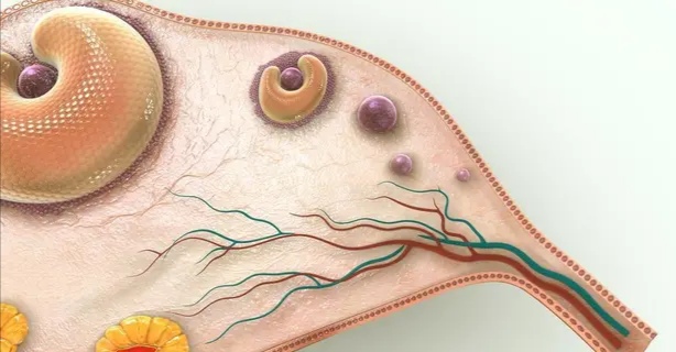 月经不调是多囊卵巢的前兆吗,月经失调怎么判断多囊卵巢不孕